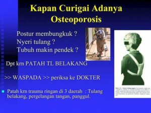 Aktivitas Fisik Penunjang Tulang Sehat