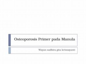 Pencegahan Osteoporosis Pada Manula