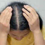 Kulit Kepala Sehat Kurangi Rontok