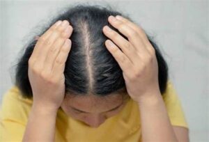 Kulit Kepala Sehat Kurangi Rontok