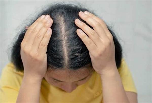 Kulit Kepala Sehat Kurangi Rontok