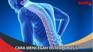 Cara Mencegah Osteoporosis Sejak Dini