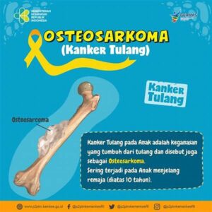 Makanan Yang Dibutuhkan Untuk Menjaga Kesehatan Tulang Adalah Makanan Yang Banyak Mengandung