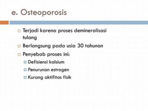 Risiko Demineralisasi Tulang Pada Usia Lanjut