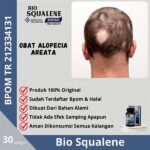 Herbal Untuk Kebotakan Rambut