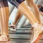 Nutrisi Penting Mencegah Osteoporosis Tulang
