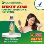 Pengobatan Herbal Alami Rambut Rontok