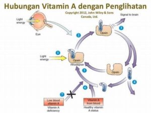 Konsumsi Vitamin A Dan Kualitas Penglihatan