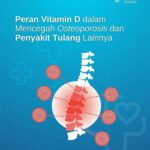 Vitamin D Mencegah Osteoporosis