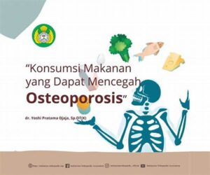 Makanan Pencegah Osteoporosis Pada Dewasa