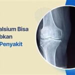 Kekurangan Kalsium Dan Keropos Tulang