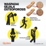 Osteoporosis Pencegahan Dengan Olahraga