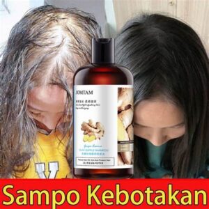 Memilih Produk Perawatan Rambut Rontok